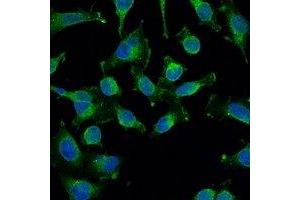 Immunofluorescent analysis of EGFR staining in Hela cells. (EGFR 抗体)