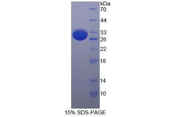 CD103 蛋白