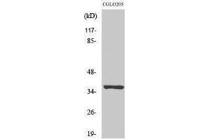 OR52E5 抗体  (Internal Region)