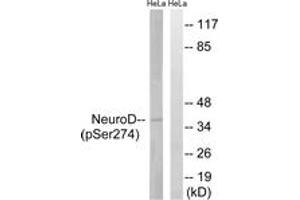 Western blot analysis of extracts from HeLa cells treated with UV 15', using Neuro D (Phospho-Ser274) Antibody. (NEUROD1 抗体  (pSer274))