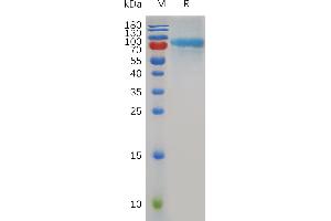 QSOX1 Protein (AA 36-708) (His tag)