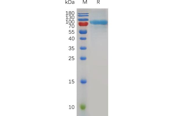 QSOX1 Protein (AA 36-708) (His tag)