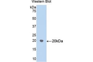 Western blot analysis of recombinant Human HSPD1. (HSPD1 抗体  (AA 172-343))