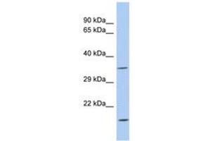 Image no. 1 for anti-Aspartate Dehydrogenase Domain Containing (ASPDH) (AA 143-192) antibody (ABIN6744016) (ASPDH 抗体  (AA 143-192))