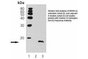 Image no. 1 for anti-Histone 3 (H3) (pSer10) antibody (ABIN363923) (Histone 3 抗体  (pSer10))