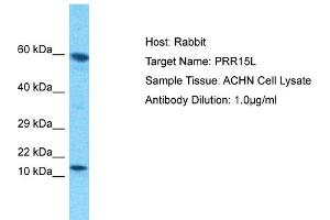 Host: Rabbit Target Name: PRR15L Sample Tissue: Human ACHN Whole Cell Antibody Dilution: 1ug/ml (PRR15L 抗体  (C-Term))