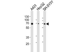 Western blot analysis of lysates from A431, HepG2, SH-SY5Y cell line (from left to right), using EIF2AK2 Antibody (ABIN6243641 and ABIN6577090). (EIF2AK2 抗体  (AA 1-250))