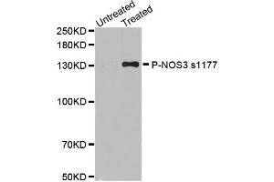 Western blot analysis of extracts of various cell lines, using Phospho-NOS3-S1177 antibody (ABIN2988223). (ENOS 抗体  (pSer1177))