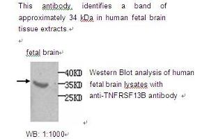 Image no. 1 for anti-Tumor Necrosis Factor Receptor Superfamily, Member 13B (TNFRSF13B) antibody (ABIN790808) (TACI 抗体)