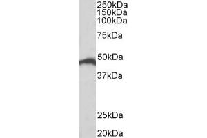 Western Blotting (WB) image for anti-Interferon Regulatory Factor 4 (IRF4) (AA 433-445) antibody (ABIN1102606) (IRF4 抗体  (AA 433-445))
