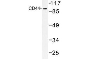 Image no. 1 for anti-CD44 (CD44) antibody (ABIN317946) (CD44 抗体)