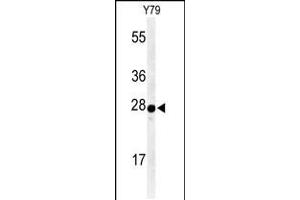 Western blot analysis of AANAT Antibody in Y79 cell line lysates (35ug/lane) (AANAT 抗体  (N-Term))