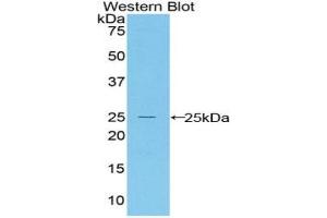 Detection of Recombinant Bax, Mouse using Polyclonal Antibody to Bcl2 Associated X Protein (Bax) (BAX 抗体  (AA 1-158))