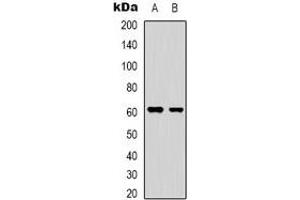 Western blot analysis of YTHDF1 expression in HepG2 (A), HEK293T (B) whole cell lysates. (YTHDF1 抗体  (N-Term))