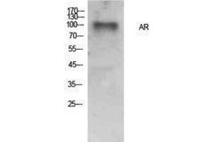 Western Blotting (WB) image for anti-Androgen Receptor (AR) (Internal Region) antibody (ABIN3178884) (Androgen Receptor 抗体  (Internal Region))