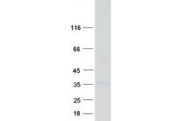 BCL2L12 Protein (Transcript Variant 1) (Myc-DYKDDDDK Tag)