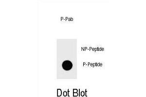 Dot blot analysis of Phospho-IKKB- Antibody Phospho-specific Pab g on nitrocellulose membrane. (IKBKB 抗体  (pSer672))