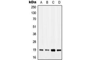 Western blot analysis of MYL7 expression in MCF7 (A), K562 (B), SP2/0 (C), H9C2 (D) whole cell lysates. (MYL7 抗体  (Center))
