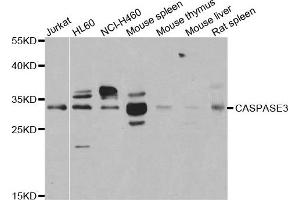 Western blot analysis of extracts of various cell lines using CASP3 antibody. (Caspase 3 抗体)