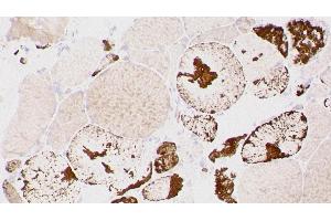 Immunohistochemistry (IHC) image for anti-Myotilin (MYOT) (C-Term) antibody (ABIN7538828) (Myotilin 抗体  (C-Term))