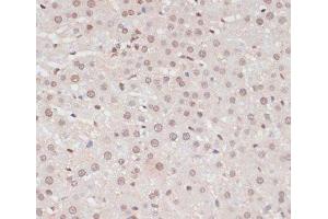 Immunohistochemistry of paraffin-embedded Rat liver using Phospho-STAT1(S727) Polyclonal Antibody at dilution of 1:100 (40x lens). (STAT1 抗体  (pSer727))