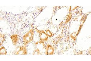 Immunohistochemistry (IHC) image for anti-Glyceraldehyde-3-Phosphate Dehydrogenase (GAPDH) (C-Term) antibody (ABIN185240)