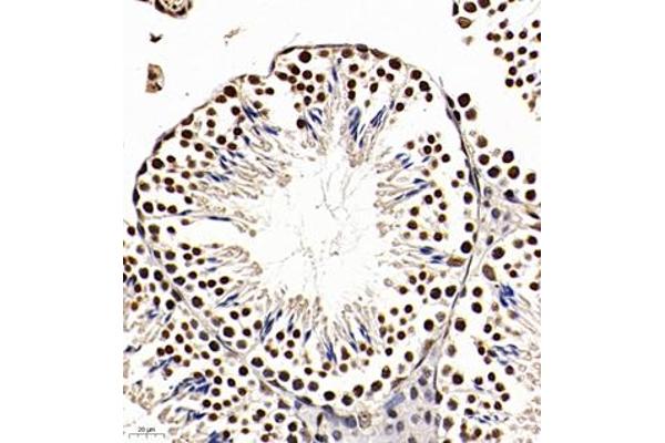 Apoptosis Inhibitor 5 抗体