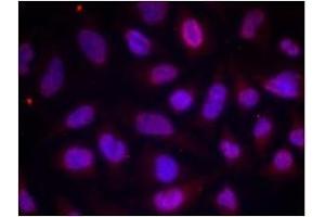 Image no. 1 for anti-Myocyte Enhancer Factor 2A (MEF2A) (pThr312) antibody (ABIN196683) (MEF2A 抗体  (pThr312))