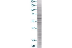 MAOB transfected lysate. (MAOB 293T Cell Transient Overexpression Lysate(Denatured))