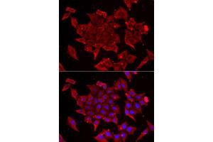 Immunofluorescence analysis of U2OS cells using TIMM17A antibody. (TIMM17A 抗体  (AA 1-171))