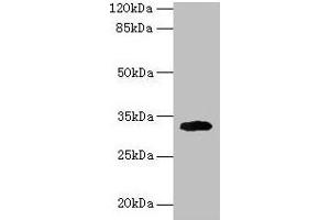 Western blot All lanes: Cd74 antibody at 2 μg/mL + Mouse lung tissue Secondary Goat polyclonal to rabbit IgG at 1/10000 dilution Predicted band size: 32, 25 kDa Observed band size: 32 kDa (CD74 抗体  (AA 57-280))