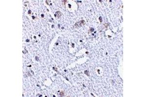Immunohistochemistry (IHC) image for anti-TP53 induced glycolysis regulatory phosphatase (TIGAR) (Middle Region 2) antibody (ABIN1031205) (TIGAR 抗体  (Middle Region 2))