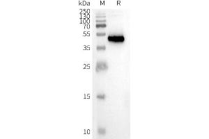 WB analysis of Human -Nanodisc with anti- monoclonal antibody (ABIN7478011 and ABIN7490961) at 1 μg/mL, followed by Goat Anti-Human IgG HRP at 1/5000 dilution (CCR8 蛋白)