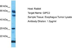 Host: Rabbit Target Name: GIPC2 Sample Type: Esophagus Tumor lysates Antibody Dilution: 1. (GIPC2 抗体  (C-Term))