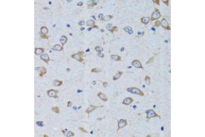 Immunohistochemistry of paraffin-embedded rat brain using RARS antibody. (RARS 抗体)