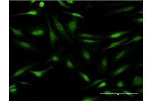 Immunofluorescence of monoclonal antibody to CALCOCO2 on HeLa cell. (CALCOCO2 抗体  (AA 347-446))