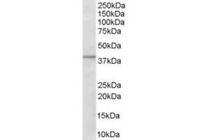 Western Blotting (WB) image for anti-ArfGAP with Dual PH Domains 1 (ADAP1) (C-Term) antibody (ABIN2465521) (ADAP1 抗体  (C-Term))