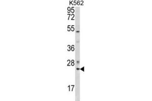 Western Blotting (WB) image for anti-RAB7A, Member RAS Oncogene Family (RAB7A) antibody (ABIN3003858) (RAB7A 抗体)