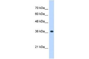 A4GNT antibody used at 0. (A4GNT 抗体  (C-Term))