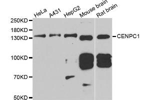Western blot analysis of extracts of various cell lines, using CENPC antibody (ABIN5973936) at 1/1000 dilution. (Centromere Protein C Pseudogene 1 (CENPCP1) 抗体)