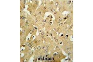 Immunohistochemistry (IHC) image for anti-Corticotropin Releasing Hormone Receptor 2 (CRHR2) antibody (ABIN3002799) (CRHR2 抗体)