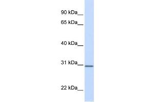 WB Suggested Anti-DCI Antibody Titration:  0. (DCI 抗体  (N-Term))