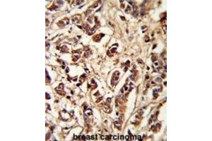 Immunohistochemistry (IHC) image for anti-Pericentriolar Material 1 (PCM1) antibody (ABIN3003242) (PCM1 抗体)