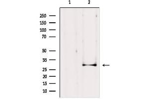 Western blot analysis of extracts from HepG2, using AQP1 Antibody. (Aquaporin 1 抗体  (Internal Region))