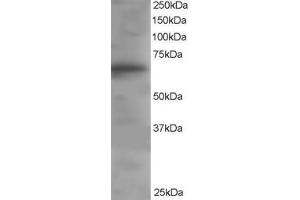 Western Blotting (WB) image for anti-Docking Protein 3 (DOK3) (C-Term) antibody (ABIN2465609) (DOK3 抗体  (C-Term))