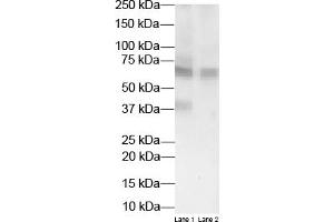 WB Suggested Anti-HSD11B1 Antibody Titration:  2 ug/ml  Positive Control:  Transient overexpression lysate of HSD11B1 and Non-overexpressed vector control lysate (HSD11B1 抗体  (N-Term))