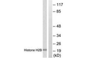 Western blot analysis of extracts from Raw264. (Histone H2B 抗体  (AA 11-60))