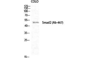 Western Blot analysis of COLO cells using Smad2 Polyclonal Antibody diluted at 1:1000. (SMAD2 抗体)