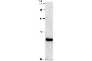 Western blot analysis of Hela cell, using PCNA Polyclonal Antibody at dilution of 1:500 (PCNA 抗体)