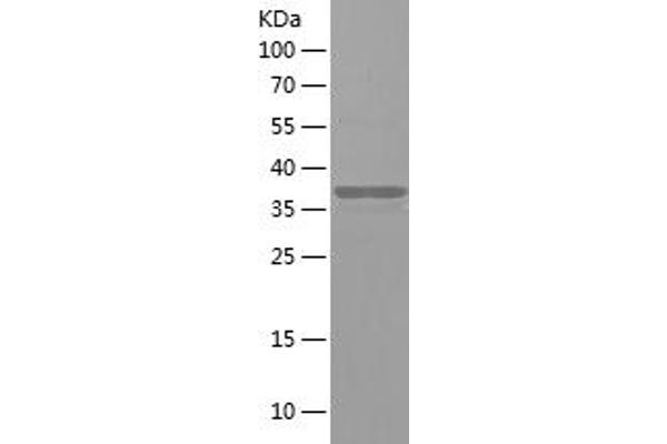 NT5C2 Protein (AA 182-335) (His-IF2DI Tag)